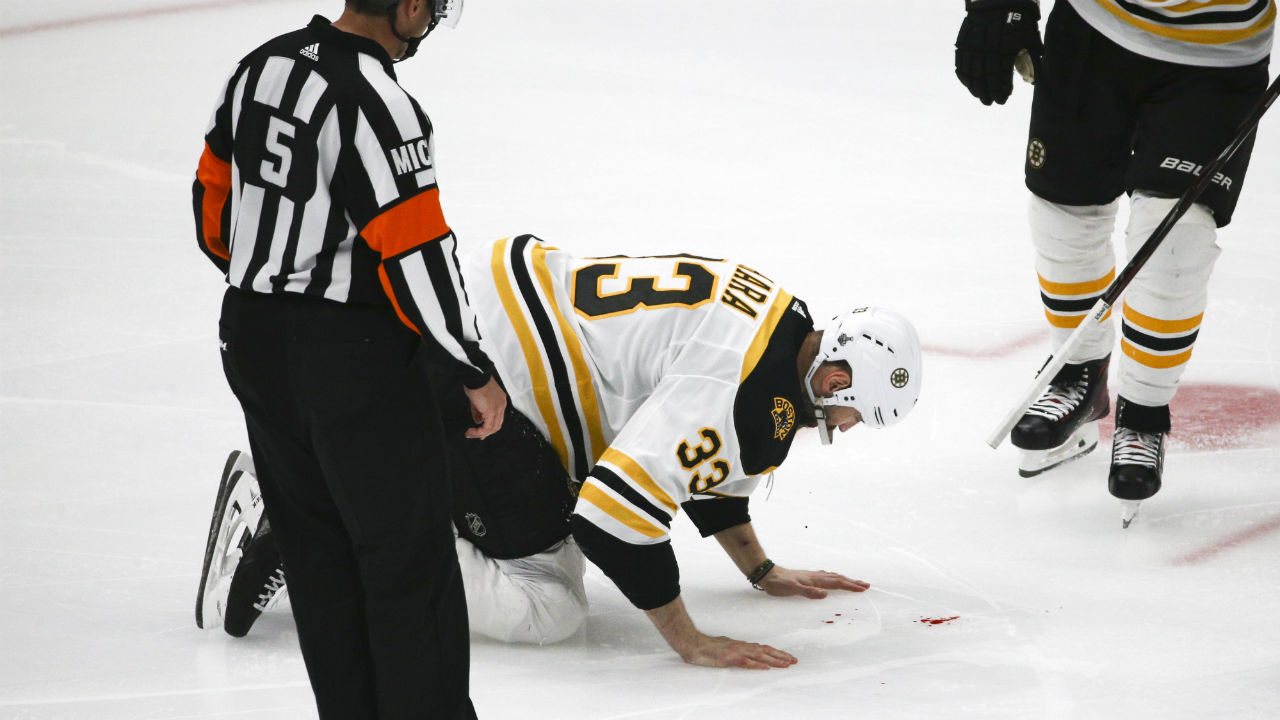 Shot to the face breaks Chara's jaw in Game 4